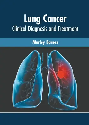 Cancerul pulmonar: Diagnostic clinic și tratament - Lung Cancer: Clinical Diagnosis and Treatment