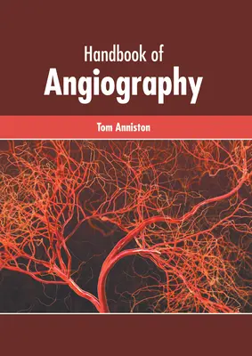 Manual de angiografie - Handbook of Angiography