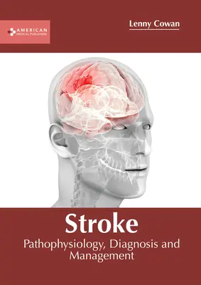 Accident vascular cerebral: Patofiziologie, diagnostic și management - Stroke: Pathophysiology, Diagnosis and Management