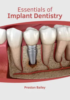 Aspecte esențiale ale implantologiei dentare - Essentials of Implant Dentistry
