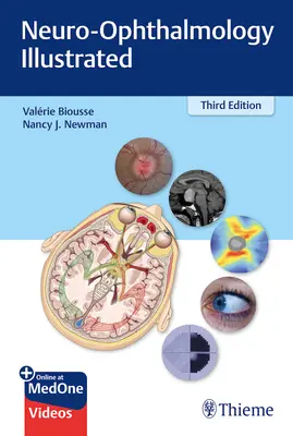Neuro-oftalmologie ilustrată - Neuro-Ophthalmology Illustrated