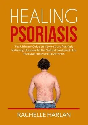 Vindecarea psoriazisului: The Ultimate Guide on How to Cure Psoriasis Naturally, Descoperiți toate tratamentele naturale pentru psoriazis și psoriazis - Healing Psoriasis: The Ultimate Guide on How to Cure Psoriasis Naturally, Discover All the Natural Treatments For Psoriasis and Psoriatic