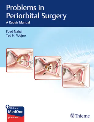 Probleme în chirurgia periorbitară: Un manual de reparații - Problems in Periorbital Surgery: A Repair Manual
