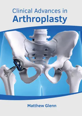 Avansuri clinice în artroplastie - Clinical Advances in Arthroplasty