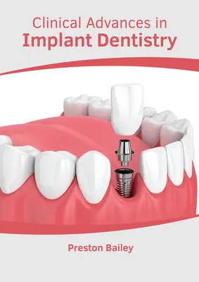 Avansuri clinice în stomatologia implantologică - Clinical Advances in Implant Dentistry