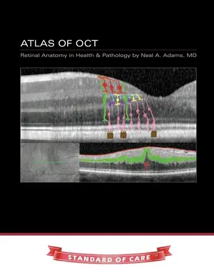Atlas de OCT: Anatomia retinei în sănătate și patologie - Atlas of OCT: Retinal Anatomy in Health & Pathology