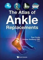 Atlasul înlocuirii gleznei (The Atlas of Ankle Replacements) - The Atlas of Ankle Replacements