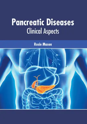 Pancreatic Diseases: Aspecte clinice - Pancreatic Diseases: Clinical Aspects
