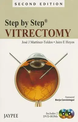 Pas cu pas: Vitrectomie [Cu 2 Dvdromuri] - Step by Step: Vitrectomy [With 2 Dvdroms]