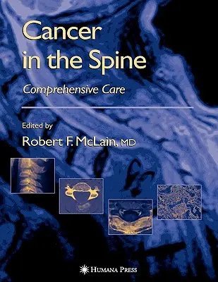 Cancerul la nivelul coloanei vertebrale: Îngrijire cuprinzătoare - Cancer in the Spine: Comprehensive Care