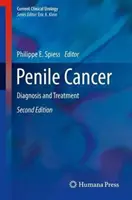 Cancerul de penis: Diagnostic și tratament - Penile Cancer: Diagnosis and Treatment