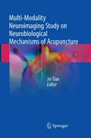 Studiu neuroimagistic multimodal asupra mecanismelor neurobiologice ale acupuncturii - Multi-Modality Neuroimaging Study on Neurobiological Mechanisms of Acupuncture