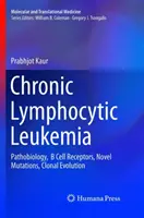 Leucemia limfocitară cronică: Patobiologie, receptori ai celulelor B, mutații noi, evoluție clonală - Chronic Lymphocytic Leukemia: Pathobiology, B Cell Receptors, Novel Mutations, Clonal Evolution