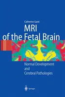 RMN al creierului fetal: Dezvoltare normală și patologii cerebrale - MRI of the Fetal Brain: Normal Development and Cerebral Pathologies