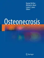 Osteonecroza - Osteonecrosis