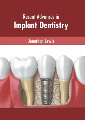 Avansuri recente în implantologia dentară - Recent Advances in Implant Dentistry
