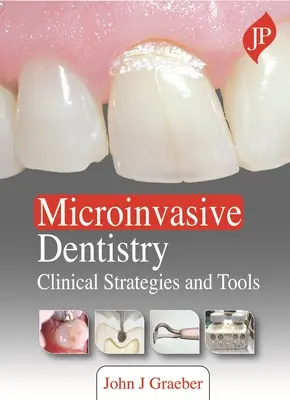 Stomatologia microinvazivă - Strategii și instrumente clinice - Microinvasive Dentistry - Clinical Strategies and Tools
