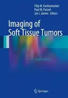 Imagistica tumorilor țesuturilor moi - Imaging of Soft Tissue Tumors