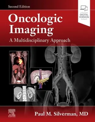 Oncologic Imaging: O abordare multidisciplinară - Oncologic Imaging: A Multidisciplinary Approach