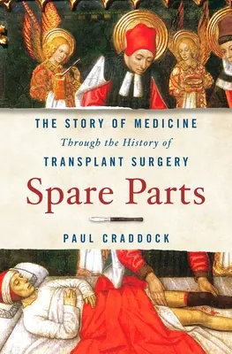 Spare Parts: The Story of Medicine Through the History of Transplant Surgery (Povestea medicinei prin istoria chirurgiei de transplant) - Spare Parts: The Story of Medicine Through the History of Transplant Surgery
