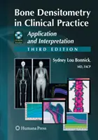 Densitometria osoasă în practica clinică: Aplicarea și interpretarea - Bone Densitometry in Clinical Practice: Application and Interpretation
