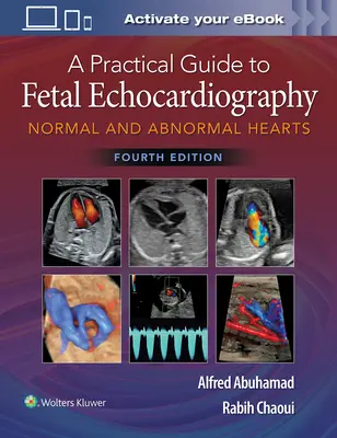 Un ghid practic pentru ecocardiografia fetală: Inimi normale și anormale - A Practical Guide to Fetal Echocardiography: Normal and Abnormal Hearts