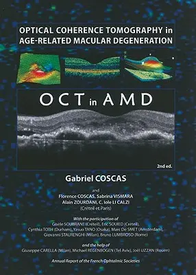Tomografia în coerență optică în degenerescența maculară legată de vârstă - Optical Coherence Tomography in Age-Related Macular Degeneration