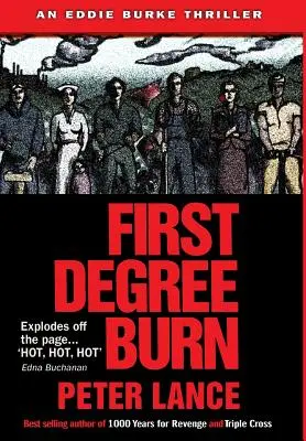 Arsură de prim grad - First Degree Burn