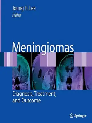 Meningioame: Diagnostic, tratament și rezultate - Meningiomas: Diagnosis, Treatment, and Outcome