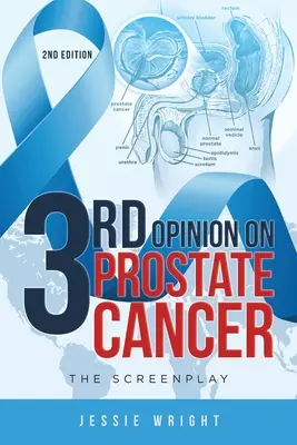 A treia opinie privind cancerul de prostată: Scenariul - 3rd Opinion on Prostate Cancer: The Screenplay