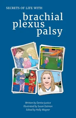 Secretele vieții cu paralizia plexului brahial - Secrets of Life with Brachial Plexus Palsy