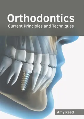 Ortodonție: Principii și tehnici actuale - Orthodontics: Current Principles and Techniques