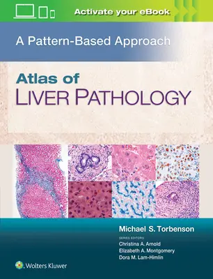Atlas de patologie hepatică: O abordare bazată pe modele - Atlas of Liver Pathology: A Pattern-Based Approach