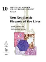 Boli neoplazice ale ficatului - Non-Neoplastic Diseases of the Liver