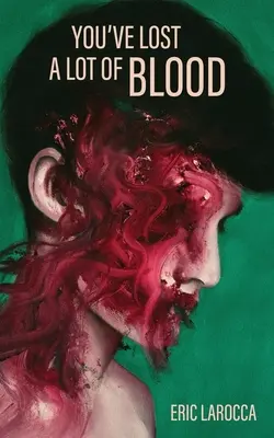 Ai pierdut mult sânge - You've Lost a Lot of Blood