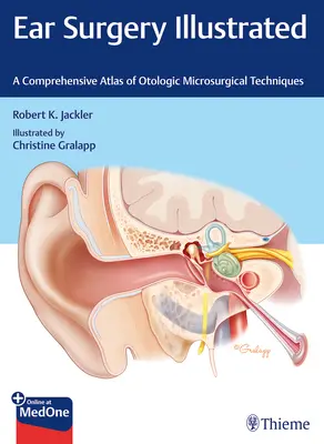 Chirurgia urechii ilustrată: Un atlas cuprinzător al tehnicilor microchirurgicale otologice - Ear Surgery Illustrated: A Comprehensive Atlas of Otologic Microsurgical Techniques