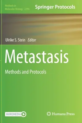 Metastaze: Metode și protocoale - Metastasis: Methods and Protocols