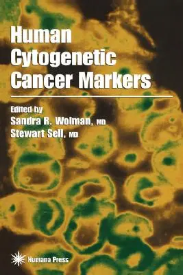 Markeri citogenetici umani ai cancerului - Human Cytogenetic Cancer Markers