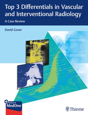 Top 3 diferențiale în radiologia vasculară și intervențională: O analiză de caz - Top 3 Differentials in Vascular and Interventional Radiology: A Case Review