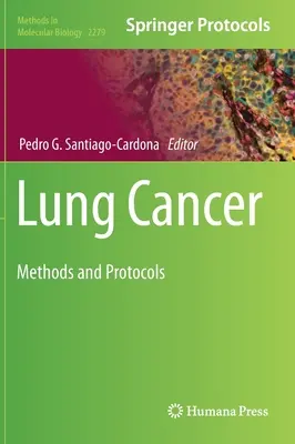Cancerul pulmonar: Metode și protocoale - Lung Cancer: Methods and Protocols