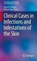 Cazuri clinice în infecții și infestații ale pielii - Clinical Cases in Infections and Infestations of the Skin