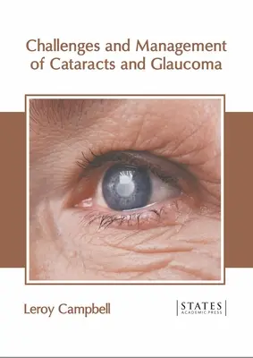 Provocările și gestionarea cataractei și a glaucomului - Challenges and Management of Cataracts and Glaucoma