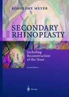 Rinoplastia secundară: Inclusiv reconstrucția nasului - Secondary Rhinoplasty: Including Reconstruction of the Nose