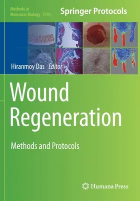 Regenerarea rănilor: Metode și protocoale - Wound Regeneration: Methods and Protocols