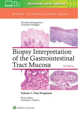 Interpretarea biopsiei mucoasei tractului gastrointestinal: Volumul 1: Non-Neoplastic - Biopsy Interpretation of the Gastrointestinal Tract Mucosa: Volume 1: Non-Neoplastic