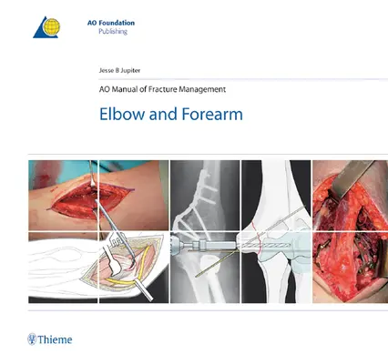 Manualul Ao de gestionare a fracturilor - cot și antebraț - Ao Manual of Fracture Management - Elbow & Forearm