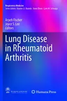Boala pulmonară în artrita reumatoidă - Lung Disease in Rheumatoid Arthritis