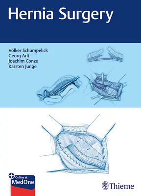 Chirurgia herniei - Hernia Surgery