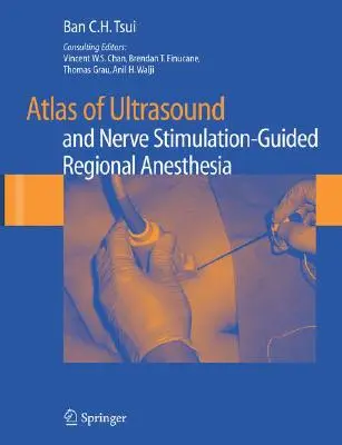 Atlas de anestezie regională ghidată de ultrasunete și stimulare nervoasă - Atlas of Ultrasound and Nerve Stimulation-Guided Regional Anesthesia