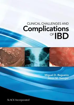 Provocări clinice și complicații ale Ibd - Clinical Challenges and Complications of Ibd